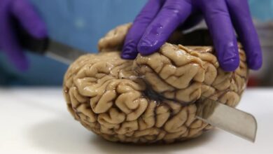 جزئی‌ترین تصویر از مغز انسان که تابه‌حال دیده‌اید!/ عکس