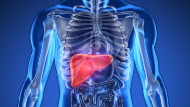 درمان کبد چرب با مصرف این داروی گیاهی