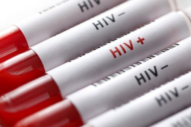 HPV از طریق استخر و سرویس بهداشتی منتقل می‌شود؟