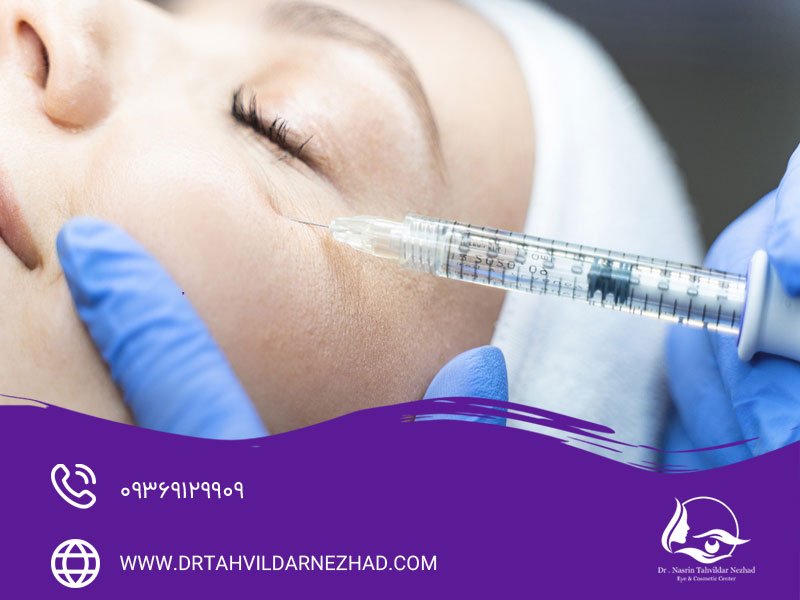 فیلر زیر چشم برای چه کسانی مناسب است؟