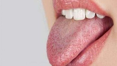 زبان سفید چه چیزی درباره سلامت می‌گوید؟