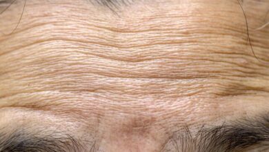 سازوکار چروک شدن پوست با افزایش سن کشف شد