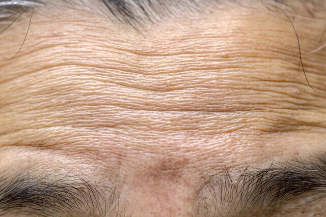 سازوکار چروک شدن پوست با افزایش سن کشف شد