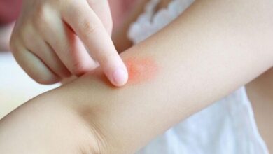 هشدار وزارت بهداشت درباره یک حشره خطرناک