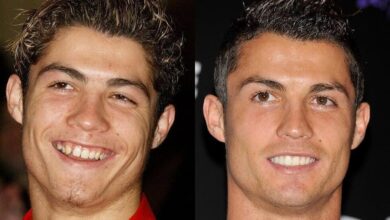 با الگوی لبخند رونالدو؛ فوتبالیست‌های ما برای نشان دادن دندان خود چه می‌کنند؟