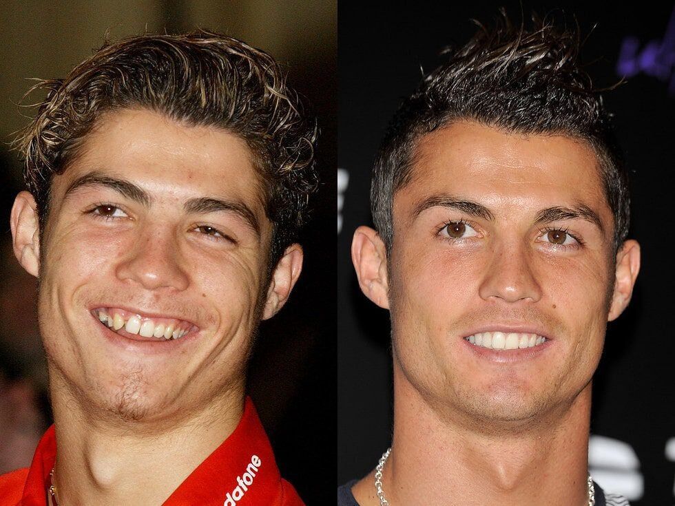 با الگوی لبخند رونالدو؛ فوتبالیست‌های ما برای نشان دادن دندان خود چه می‌کنند؟