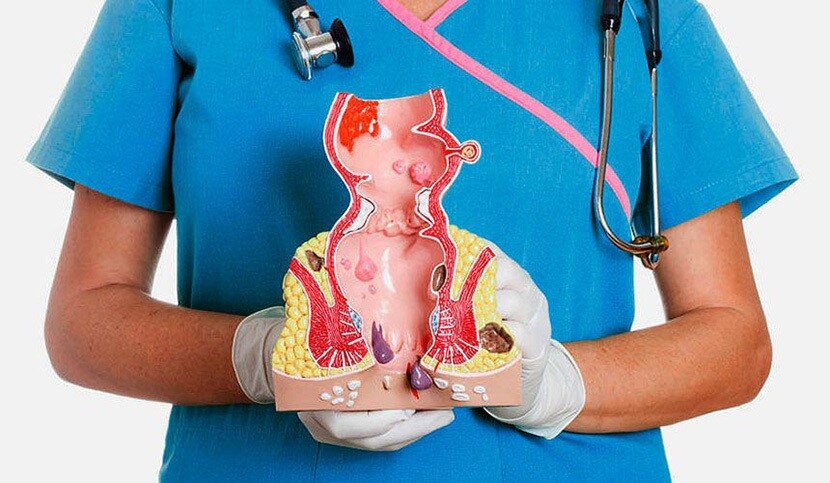 داروهای موقتی و درمان فوری بواسیر/ این غذاها بواسیر را تشدید می‌کنند/ بهترین ضمادها