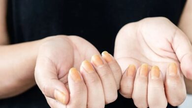 رنگ زرد ناخن نشانه چیست؟