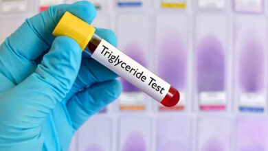 مهم‌ترین راهکار کنترل چربی خون؛ ویژه افراد ۳۰ سال به بالا