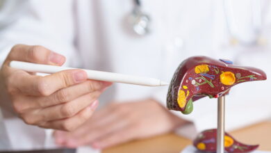 ۶ مکمل‌ و ویتامین برای کنترل بیماری کبد چرب و آنزیم‌های کبدی